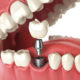 Cambie Broadway Dental