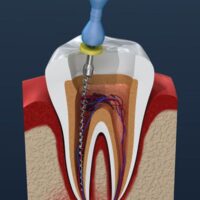 Thumbnail for the listing's main image