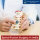 Low Cost Spinal Fusion Surgery in india