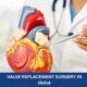 Valve Replacement Surgery Cost in India